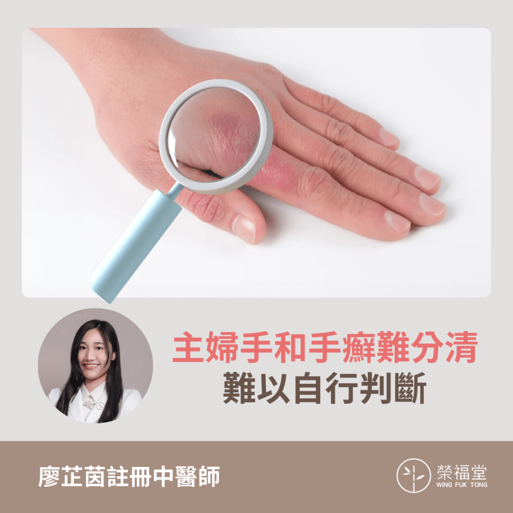 【病案分享:主婦手和手癬難分清,難以自行判斷 】廖芷茵 醫師 - 榮福堂中醫治療中心
