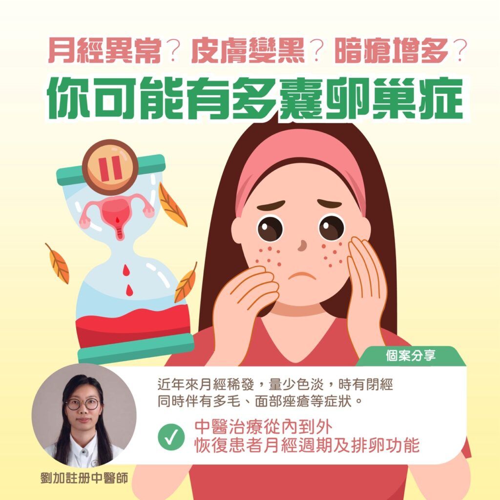 月經異常？皮膚變黑？痤瘡增多？你可能患有多囊卵巢綜合症