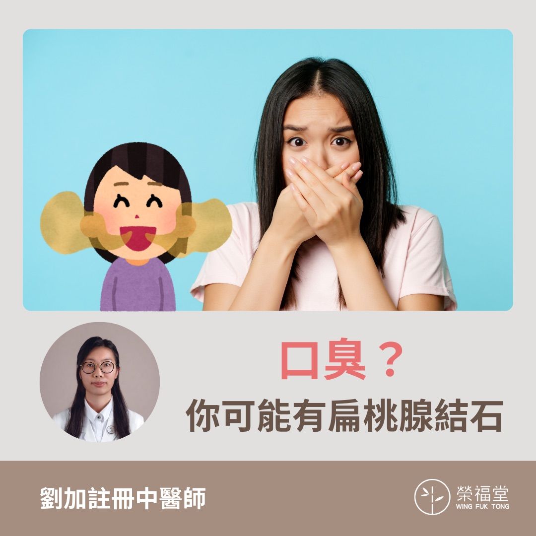 口臭？你可能有扁桃腺結石