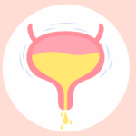 大笑咳嗽 滲尿尷尬