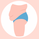 肚皮鬆弛 難收緊