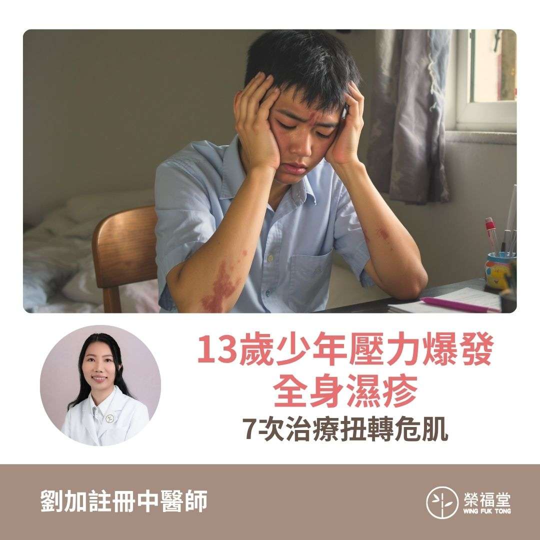 【病案分享：13歲少年壓力爆發全身濕疹 7次治療扭轉危肌】劉加醫師