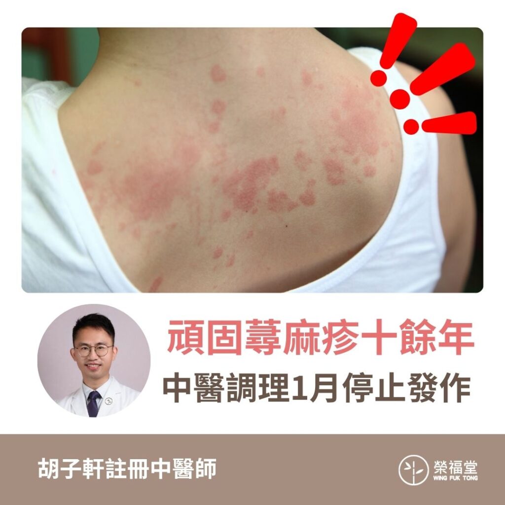 【病案分享 ：頑固蕁麻疹十餘年，中醫調理1月停止發作】胡子軒醫師