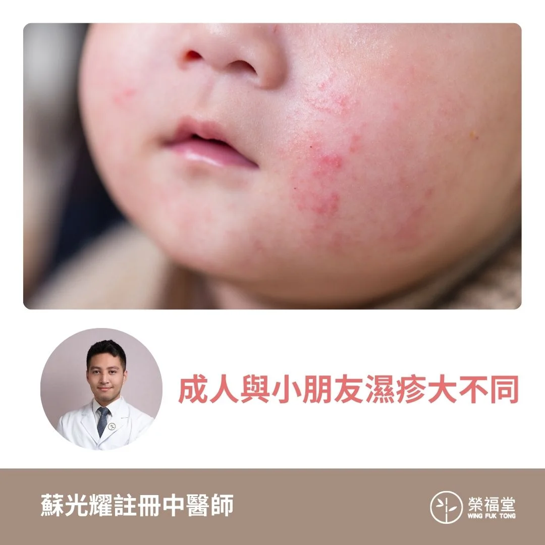 【成人與小朋友濕疹大不同】蘇光耀醫師